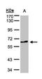 Testis Associated Actin Remodelling Kinase 2 antibody, orb73865, Biorbyt, Western Blot image 