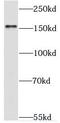 Tyrosine Kinase With Immunoglobulin Like And EGF Like Domains 1 antibody, FNab08689, FineTest, Western Blot image 