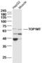 DNA Topoisomerase I antibody, orb11498, Biorbyt, Western Blot image 