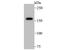Nuclear Receptor Coactivator 1 antibody, A00856, Boster Biological Technology, Western Blot image 
