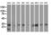 Peroxisomal Trans-2-Enoyl-CoA Reductase antibody, LS-C115675, Lifespan Biosciences, Western Blot image 