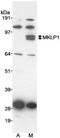 Kinesin Family Member 23 antibody, NB100-211, Novus Biologicals, Western Blot image 