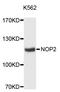 Putative ribosomal RNA methyltransferase NOP2 antibody, STJ114592, St John
