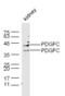 Platelet-derived growth factor C antibody, GTX51652, GeneTex, Western Blot image 