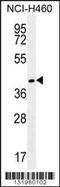 Gamma-Glutamyl Hydrolase antibody, 56-199, ProSci, Western Blot image 