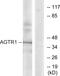 Angiotensin II type-1 receptor antibody, GTX87790, GeneTex, Western Blot image 