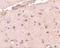 BRCA1/BRCA2-Containing Complex Subunit 3 antibody, GTX31765, GeneTex, Immunohistochemistry paraffin image 
