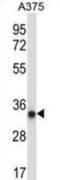 Protein Kinase AMP-Activated Non-Catalytic Subunit Beta 2 antibody, abx033144, Abbexa, Western Blot image 