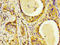 Laminin subunit beta-3 antibody, LS-C670568, Lifespan Biosciences, Immunohistochemistry paraffin image 