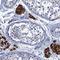 LDM antibody, HPA041325, Atlas Antibodies, Immunohistochemistry frozen image 