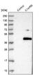 Chromosome 1 Open Reading Frame 56 antibody, NBP1-82174, Novus Biologicals, Western Blot image 
