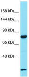 Leucine Rich Repeat Containing 37A antibody, TA337419, Origene, Western Blot image 