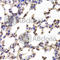 Complement C1r subcomponent antibody, A6360, ABclonal Technology, Immunohistochemistry paraffin image 