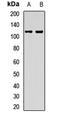 ER Membrane Protein Complex Subunit 1 antibody, LS-C668182, Lifespan Biosciences, Western Blot image 