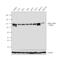 Actinin Alpha 1 antibody, PA5-17308, Invitrogen Antibodies, Western Blot image 