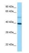 Stimulated by retinoic acid gene 8 protein antibody, NBP1-98492, Novus Biologicals, Western Blot image 