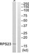 Ribosomal Protein S23 antibody, PA5-38973, Invitrogen Antibodies, Western Blot image 