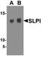 Secretory Leukocyte Peptidase Inhibitor antibody, NBP1-76396, Novus Biologicals, Western Blot image 
