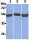Keratin 17 antibody, GTX57612, GeneTex, Western Blot image 