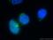Multiple Coagulation Factor Deficiency 2 antibody, 13068-1-AP, Proteintech Group, Immunofluorescence image 