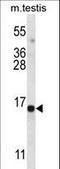 Spermatogenesis Associated 19 antibody, LS-C161481, Lifespan Biosciences, Western Blot image 