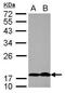 PTHR antibody, GTX100762, GeneTex, Western Blot image 