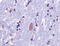 Ubiquitin B antibody, BML-UG9511-0100, Enzo Life Sciences, Immunohistochemistry paraffin image 