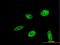 Hes Related Family BHLH Transcription Factor With YRPW Motif Like antibody, H00026508-M03, Novus Biologicals, Immunofluorescence image 