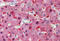 CAD protein antibody, MBS244404, MyBioSource, Immunohistochemistry frozen image 