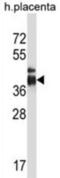 Intelectin 2 antibody, abx027537, Abbexa, Western Blot image 