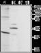 Bradykinin Receptor B1 antibody, GTX35257, GeneTex, Western Blot image 