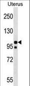 NLR Family Pyrin Domain Containing 4 antibody, LS-C158401, Lifespan Biosciences, Western Blot image 