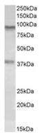 Amine Oxidase Copper Containing 3 antibody, AP32053PU-N, Origene, Western Blot image 
