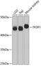 Transcription Factor Dp-1 antibody, GTX33162, GeneTex, Western Blot image 