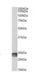 Suppressor Of Cytokine Signaling 1 antibody, orb334080, Biorbyt, Western Blot image 