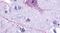 NK-3R antibody, PA5-34248, Invitrogen Antibodies, Immunohistochemistry frozen image 