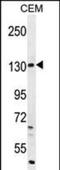 Dual Oxidase 2 antibody, MBS649569, MyBioSource, Western Blot image 