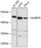 Probable alpha-ketoglutarate-dependent dioxygenase ABH5 antibody, 14-098, ProSci, Western Blot image 