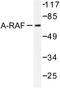 A-Raf Proto-Oncogene, Serine/Threonine Kinase antibody, AP06495PU-N, Origene, Western Blot image 
