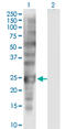 SSX Family Member 1 antibody, LS-C198268, Lifespan Biosciences, Western Blot image 