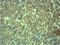 Ectopic P-Granules Autophagy Protein 5 Homolog antibody, GTX34366, GeneTex, Immunohistochemistry paraffin image 