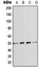 SMAD Family Member 7 antibody, MBS821041, MyBioSource, Western Blot image 