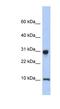 Ribosomal Protein S21 antibody, NBP1-54792, Novus Biologicals, Western Blot image 