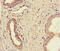 Nuclear RNA Export Factor 5 antibody, A63066-100, Epigentek, Immunohistochemistry paraffin image 