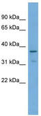 Protein Tob1 antibody, TA340077, Origene, Western Blot image 