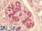 SIK Family Kinase 3 antibody, LS-B9603, Lifespan Biosciences, Immunohistochemistry paraffin image 