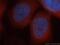 Proteasome 26S Subunit, ATPase 2 antibody, 14905-1-AP, Proteintech Group, Immunofluorescence image 
