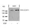 ERBB2 antibody, NB100-81961, Novus Biologicals, Western Blot image 