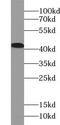 Acetyl-CoA Acyltransferase 2 antibody, FNab00059, FineTest, Western Blot image 
