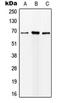 Insulin Like Growth Factor Binding Protein Acid Labile Subunit antibody, orb214088, Biorbyt, Western Blot image 